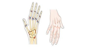 Rheumatology
